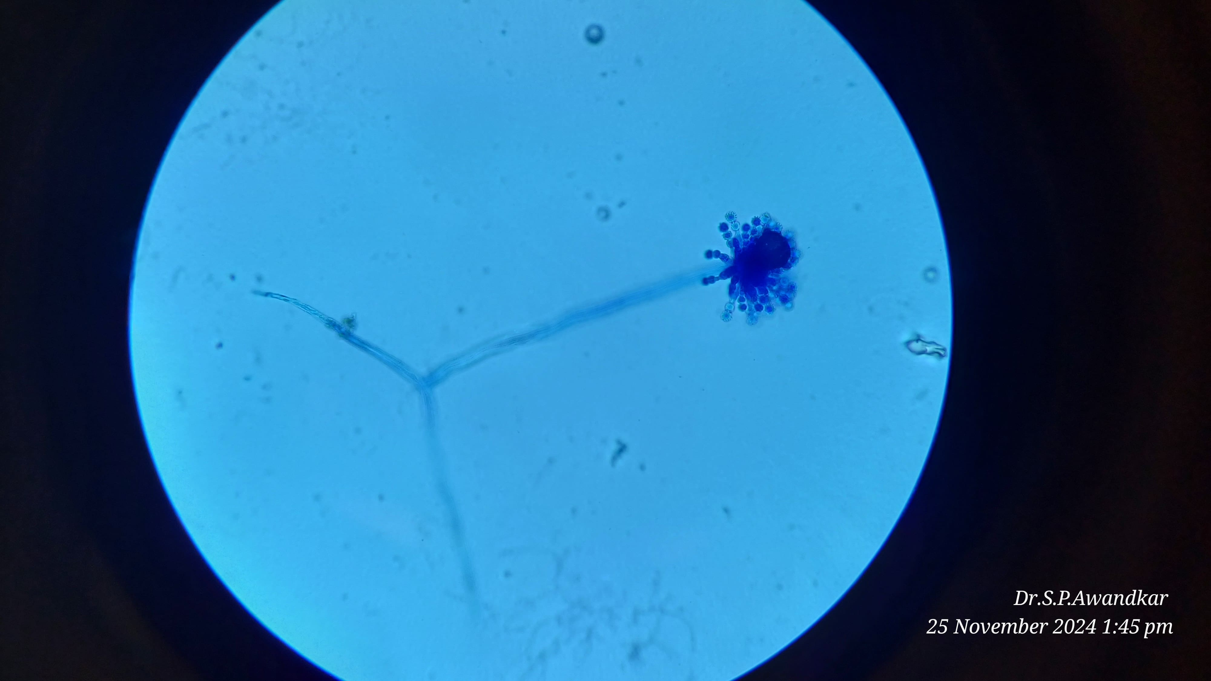 39. Aspergillus Fumigatous Microscopic